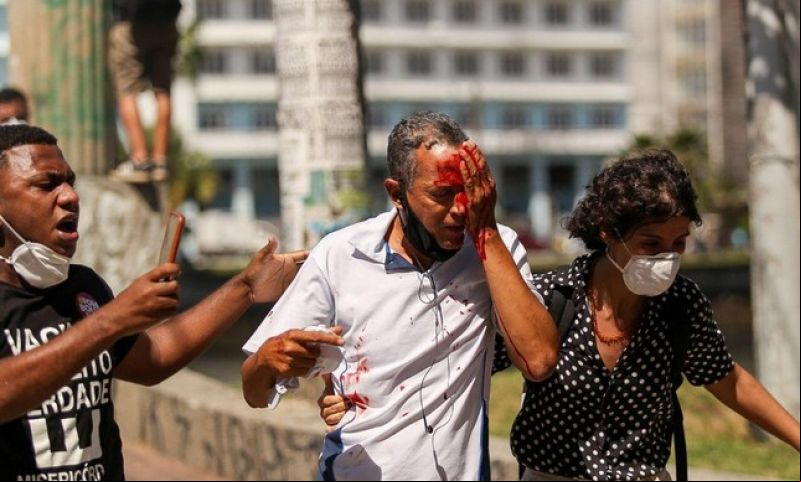 Homem que não participava do protesto é ferido no olho por tiro de bala de borracha disparada pela PM | Foto: INSTAGRAM @hugomunizzz/REUTERS