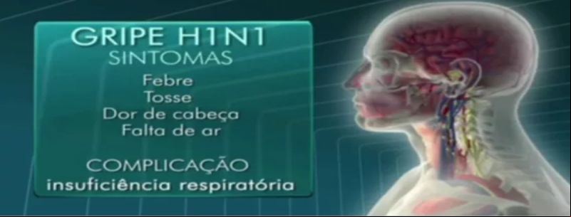 Entenda alguns sintomas da Influenza H1N1 